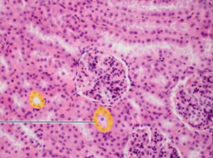 The highlighted epithelial tissue is simple cuboidal epithelium.