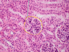 The highlighted epithelial tissue is simple squamous epithelium.