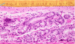 The highlighted epithelium is pseudostratified columnar epithelium.