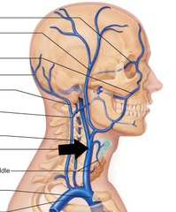 The internal jugular vein joins with which vein to form the brachiocephalic vein