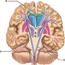 The letter A in the figure indicates which of the following structures?

cerebral nuclei 
lateral ventricles 
thalamus 
hypothalamus
