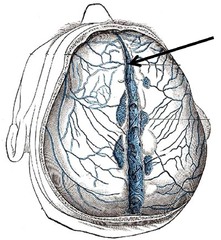 The superior sagittal sinus is contained within what structure of the dura matter
