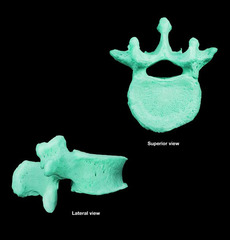 vertebra is an example of what type of bone?