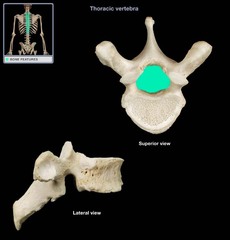 Vertebral foramen