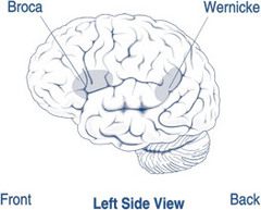 Wernicke's area (temporal lobe)