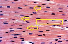 what do skeletal muscle and cardiac muscle have in common?