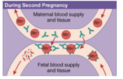 What evidence in this figure indicates that this is not a first pregnancy?
