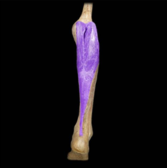 What is the action of the gastrocnemius muscle?