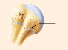 What is the functional classification of the joint in the given illustration?