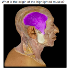 What is the origin of the highlighted muscle?