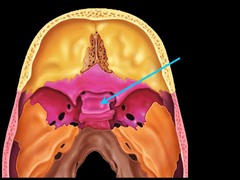 What organ is located in the hypophyseal fossa of the sphenoid bone?
