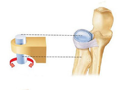 What type of joint is formed between the radius and ulna?