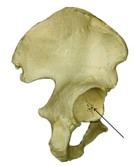 Which concave socket exists on the lateral surface of each hip bone and receives the head of the femur?