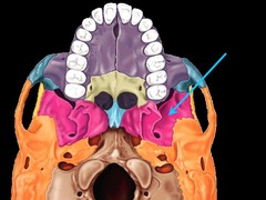 Which cranial bone spans the width of the cranial floor?