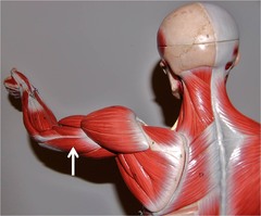 Which muscle extends the elbow?