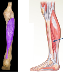 Which muscle is a synergist for plantar flexion?