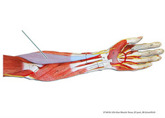 Which muscle is highlighted?
A. extensor carpi radialis brevis
B. pronator teres
C. extensor carpi radialis longus
D. brachioradialis