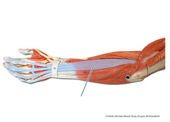 Which muscle is highlighted?
A. extensor carpi radialis longus
B. extensor carpi radialis brevis
C. extensor digitorum
D. extensor carpi ulnaris