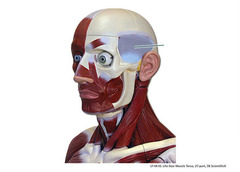 Which muscle is highlighted?
A. orbicularis oculi
B. temporalis
C. epicranius
D. lateral pterygoid