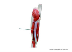 Which muscle is highlighted?
A. semimembranosus
B. semitendinosus
C. gluteus medius
D. gracilis