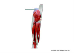 Which muscle is highlighted?
A. semitendinosus
B. gluteus maximus
C. biceps femoris
D. gluteus medius