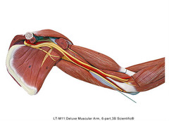Which muscle is highlighted?
A. triceps brachii, medial head
B. triceps brachii, long head
C. brachialis
D. biceps brachii