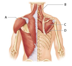 Which muscle is the prime mover of arm abduction (assuming all fibers are used)?

A 
B 
C 
D
