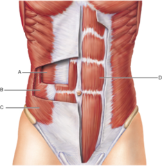 Which muscle originates on the pubic crest and symphysis and inserts on the xiphoid process and costal cartilages of ribs V through VII?

A 
B 
C 
D