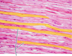 Which neuroglial cell type forms the myelin sheath in the peripheral nervous system?