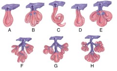 Which of the diagrams in the figure below represents a compound tubuloacinar exocrine gland?