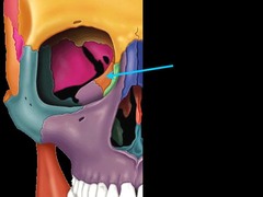 Which of the following bones is not a facial bone? Ethmoid, Zygomatic, Inferior nasal concha, or Maxillary