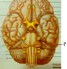 Which of the following cranial nerves carries only motor information?