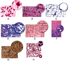 Which of the following figures shows tissue found along the developing bones of the embryo?