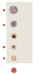 Which of the labels in the figure indicates a cell normally found in the circulating blood?