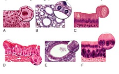 Which of the light micrographs in the figure below shows a simple columnar epithelium?