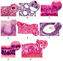Which of the light micrographs in the following figure shows a type of epithelial tissue whose functions include movement of mucus over their apical surface by ciliary action?