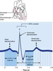 Which portion of the electrocardiogram represents the depolarization wave received by the atria from the sinoatrial (SA) node?