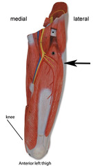 Which structure is indicated by the arrow?
A. tensor fasciae latae
B. gracilis
C. vastus lateralis
D. iliotibial tract
