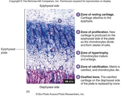 Within the epiphyseal plate, which zone houses actively dividing cartilage cells in their lacunae?
