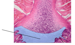 Zone of endochondral ossification
